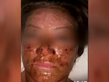 Una víctima de la clínica del terror de Marbella Una víctima de la clínica del terror de Marbella