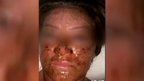 Una víctima de la clínica del terror de Marbella Una víctima de la clínica del terror de Marbella