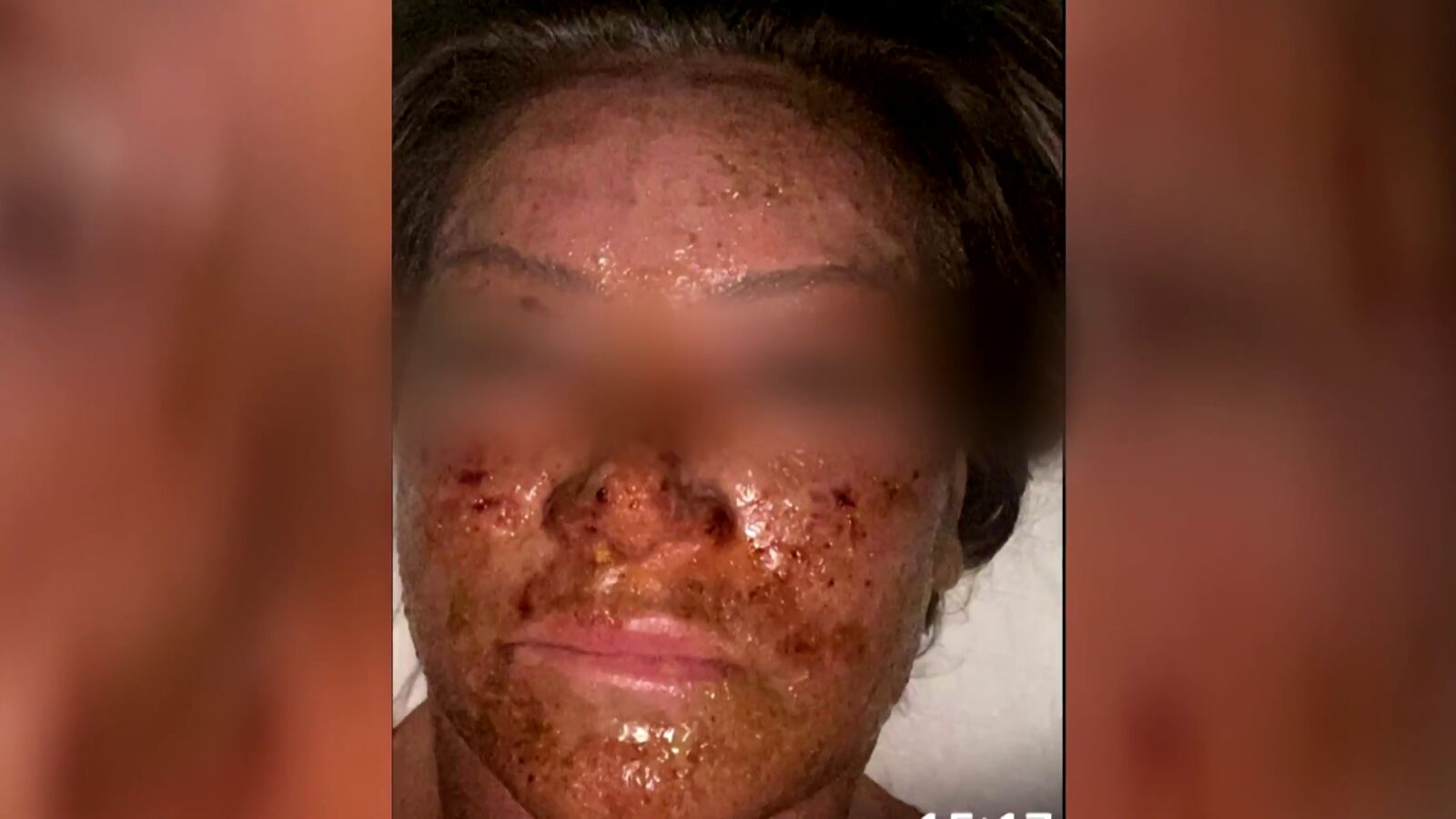 Tres detenidos en la 'clínica del terror de Marbella' tras la denuncia de 10 pacientes con secuelas físicas