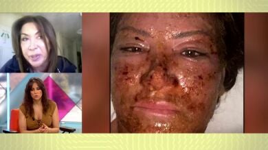 Los destrozos de 'la clínica de belleza de los horrores' de Puerto Banús: 