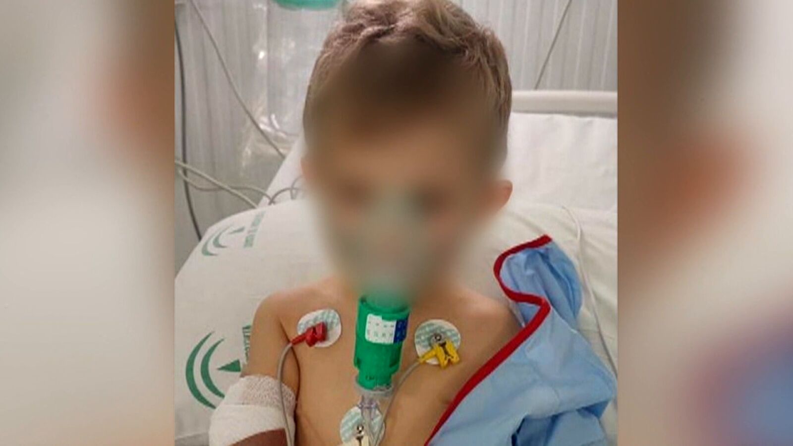 Un niño de 3 años acaba en la UCI tras 4 diagnósticos erróneos: 