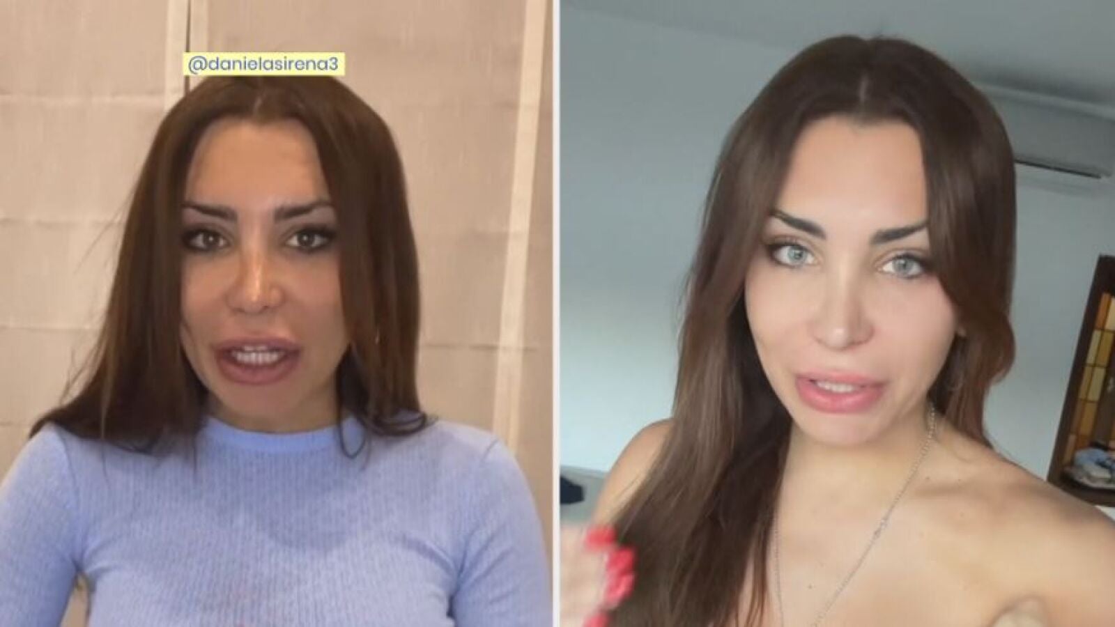 Así es la polémica operación de cambio de color de ojos de una influencer desaconsejada por los expertos