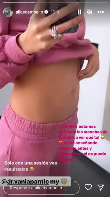 La tripa de Alice Campello dos meses después de dar a luz La tripa de Alice Campello dos meses después de dar a luz