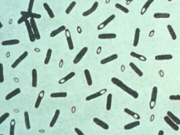 Imagen de la bacteria del botulismo, Clostridium botulinum