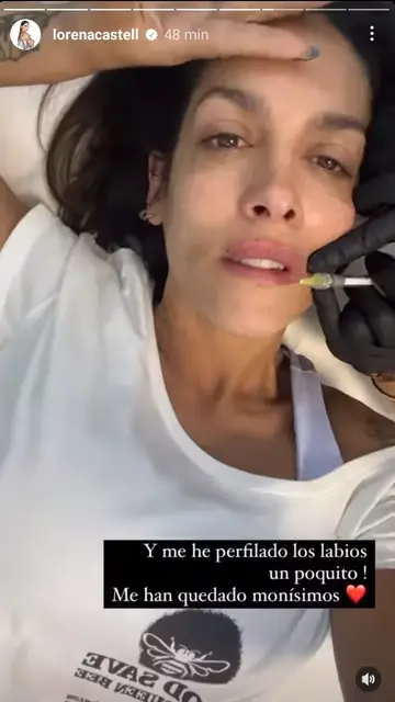 Proceso retoque estético Lorena Castell Proceso retoque estético Lorena Castell