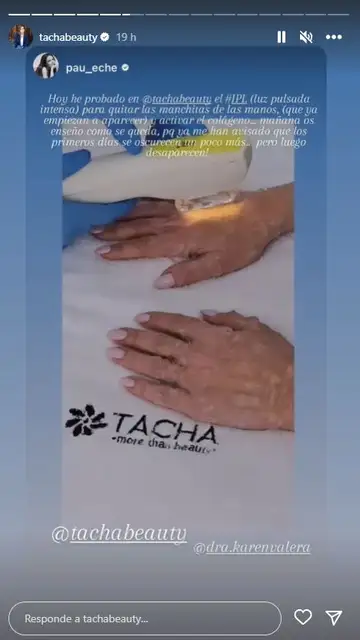 Paula Echevarría se somete a la IPL Paula Echevarría se somete a la IPL