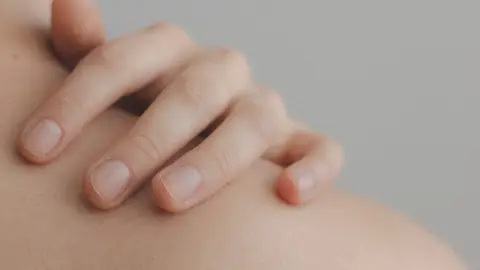 Uñas sanas Uñas sanas