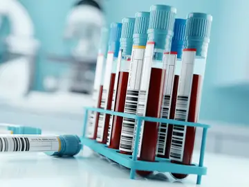 Análisis de sangre Análisis de sangre