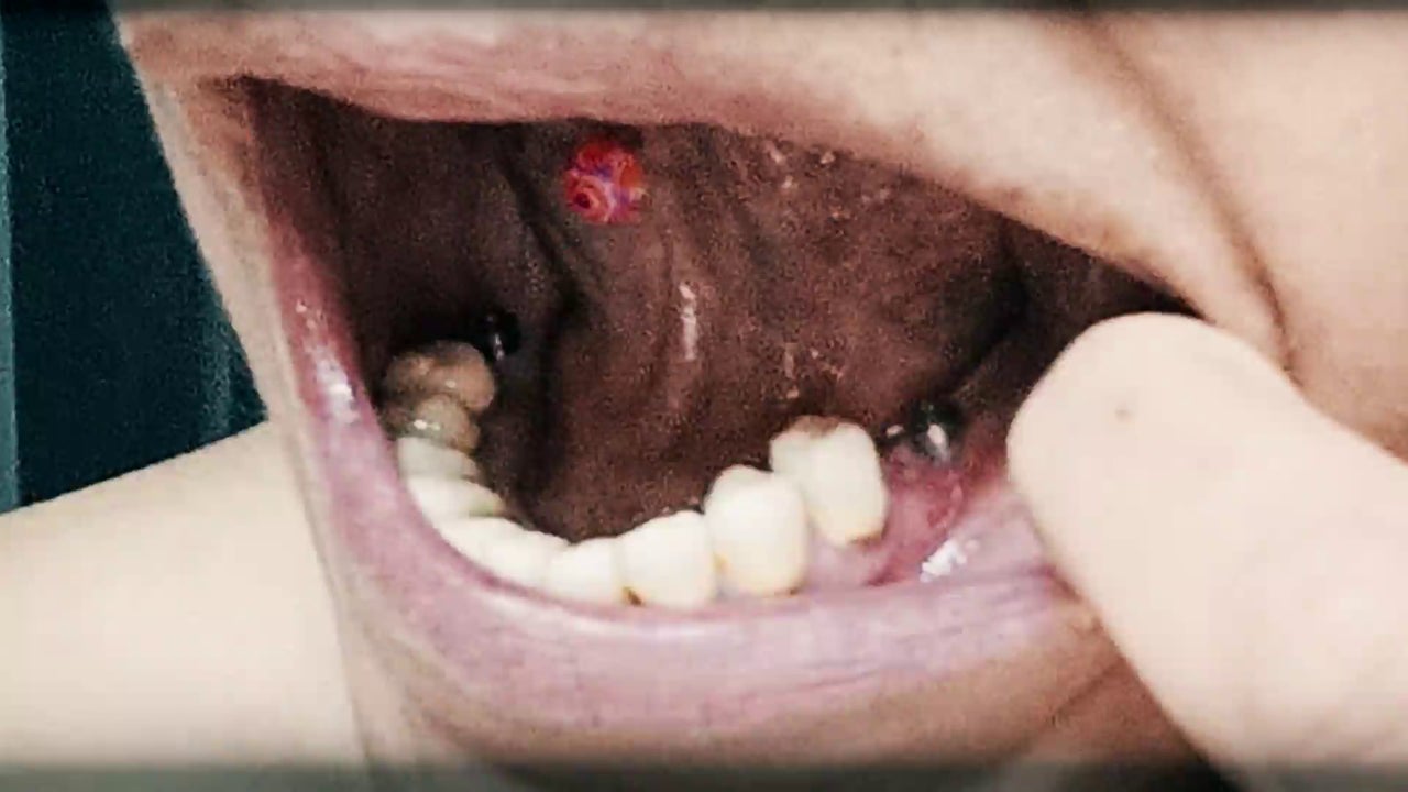 Sin dientes, con dolor y sin miles de euros...casi 200 personas denuncian  haber sido "estafados" por una clínica dental
