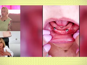 Se opera en Turquía y vuelve sin dientes. Se opera en Turquía y vuelve sin dientes.