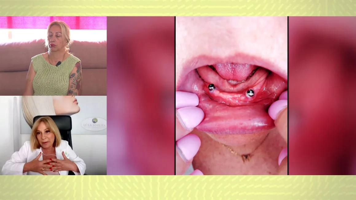 Se opera en Turquía y vuelve sin dientes. Se opera en Turquía y vuelve sin dientes.