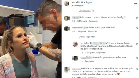 Verdeliss responde a los comentarios Verdeliss responde a los comentarios