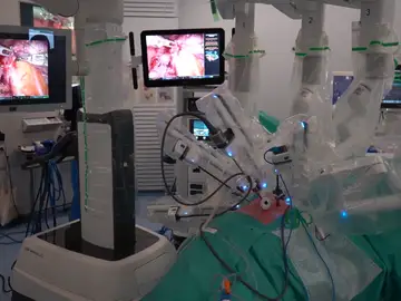 Trasplante realizado en el Hospital Vall d'Hebron de Barcelona Trasplante realizado en el Hospital Vall d'Hebron de Barcelona