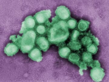 El CSIC participa en la elaboración del nuevo plan de la OMS para hacer frente a futuras pandemias de gripe