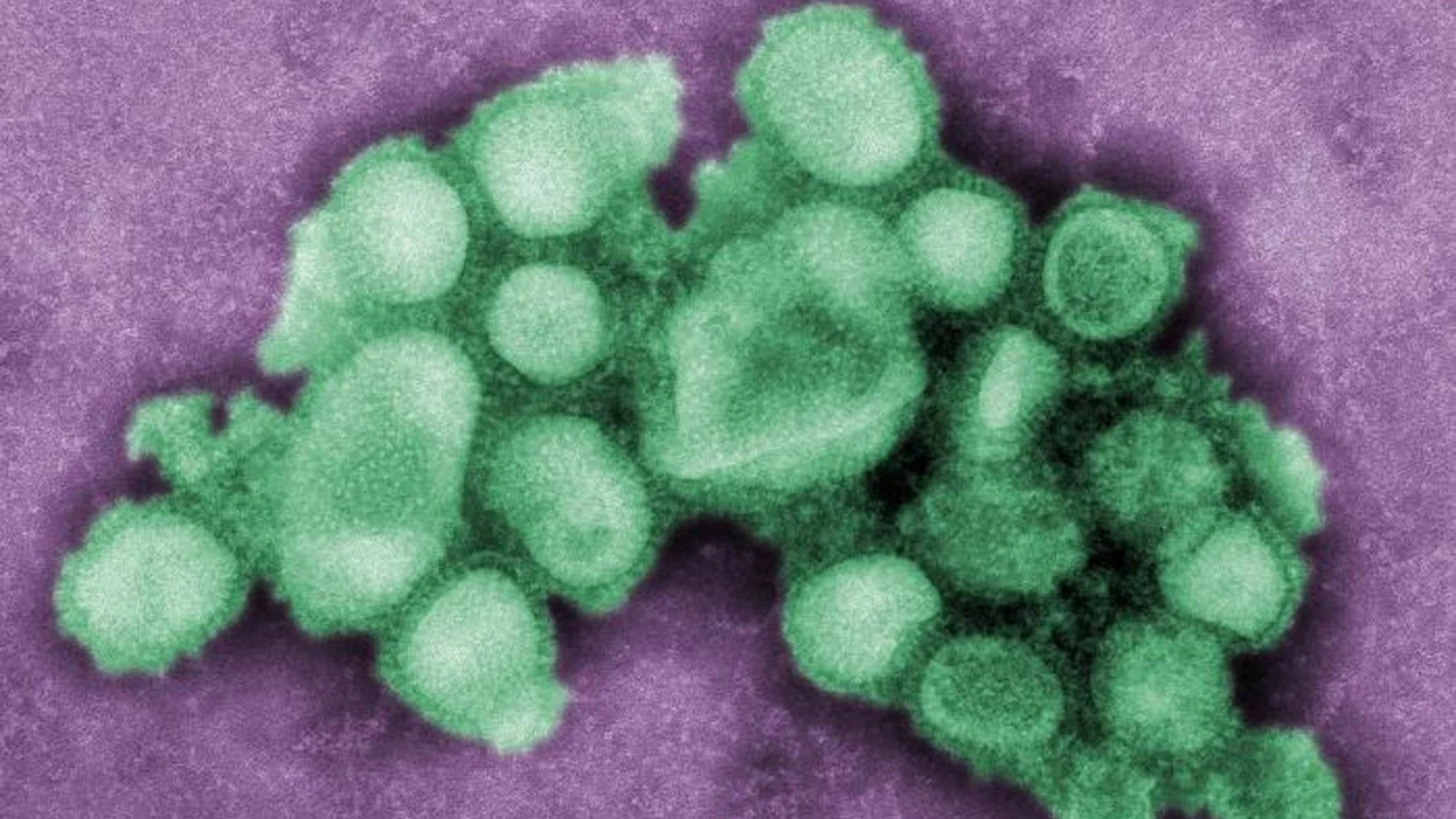 El CSIC participa en la elaboración del nuevo plan de la OMS para hacer frente a futuras pandemias de gripe