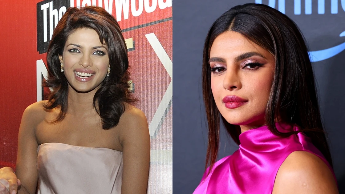 Priyanka Chopra antes y despu&eacute;s