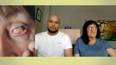 Domi, la mujer que ha vivido 54 años con una piedra en un ojo: 