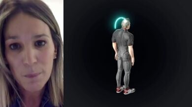 El caso del tetrapléjico que ha vuelto a caminar abre nuevos horizontes: 