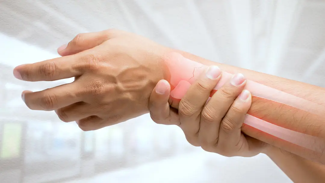 Imagen de archivo de un brazo dolorido Imagen de archivo de un brazo dolorido