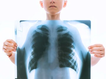 Un nuño sujeta una radiografía de torax