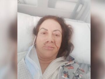 Carmen Castañeda, la mujer cuyo rostro ha quedado desfigurado tras una operación