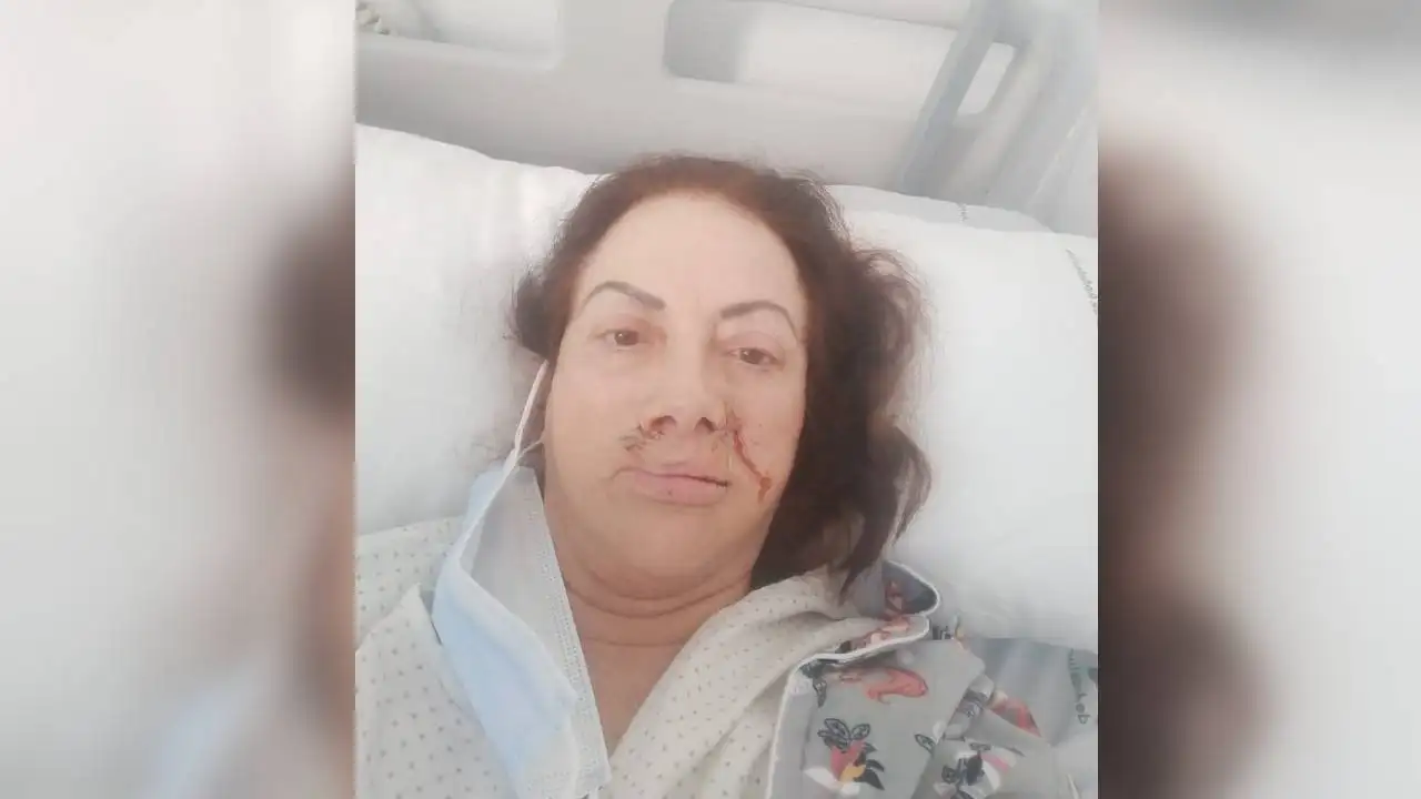 Carmen Castañeda, la mujer cuyo rostro ha quedado desfigurado tras una operación Carmen Castañeda, la mujer cuyo rostro ha quedado desfigurado tras una operación