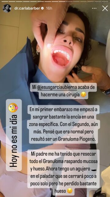 Carla Barber va al dentista por un problema en la encía