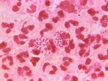 Bacteria 'Neisseria gonorrhoeae'