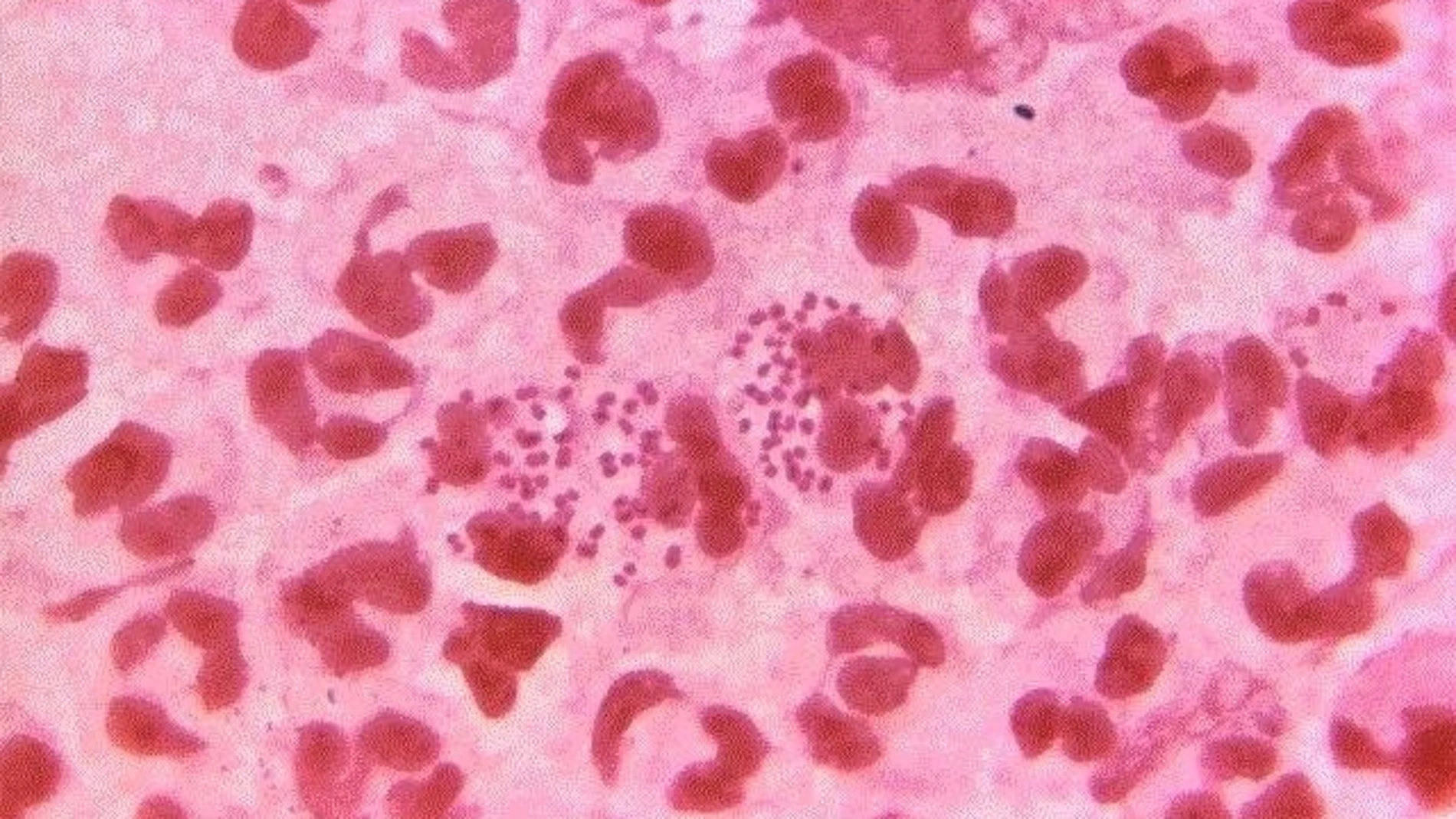 Bacteria &#39;Neisseria gonorrhoeae&#39;