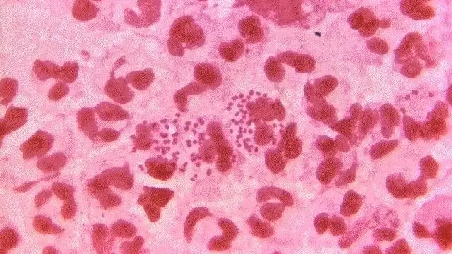 Bacteria 'Neisseria gonorrhoeae'
