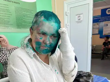 La periodista rusa agredida en Chechenia La periodista rusa agredida en Chechenia