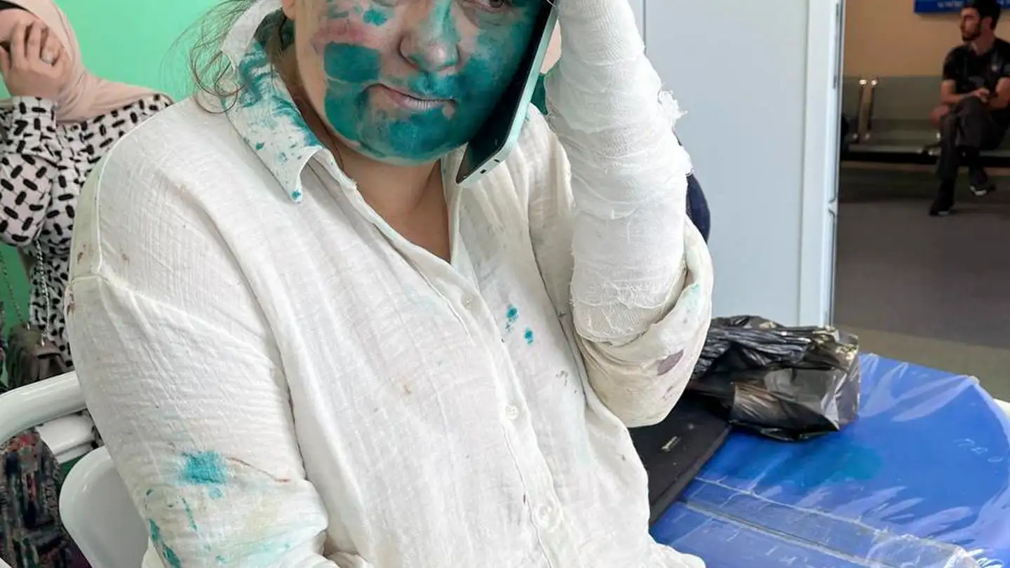La periodista rusa agredida en Chechenia La periodista rusa agredida en Chechenia