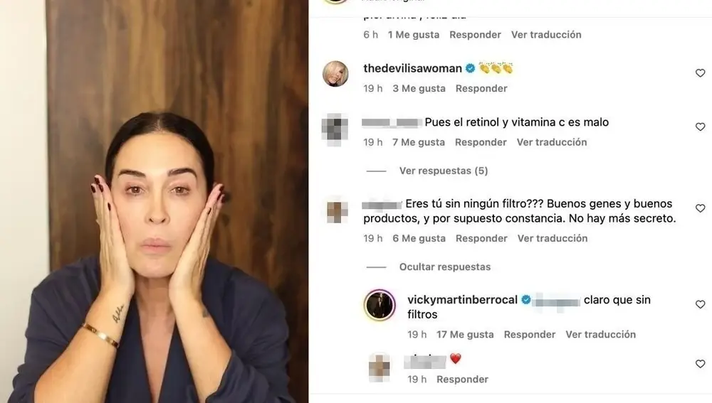 Vicky Martín Berrocal responde a la duda de una seguidora