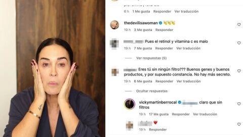 Vicky Martín Berrocal responde a la duda de una seguidora