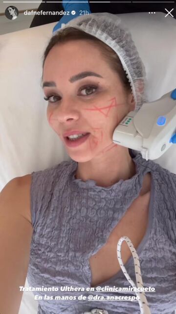 El tratamiento de belleza que Dafne Fernández se hace una vez al año