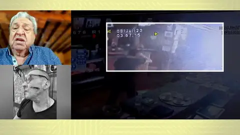 Cocinero agredido. Cocinero agredido.