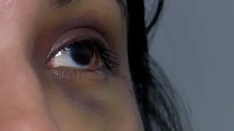 La mujer víctima de una agresión con taladro La mujer víctima de una agresión con taladro