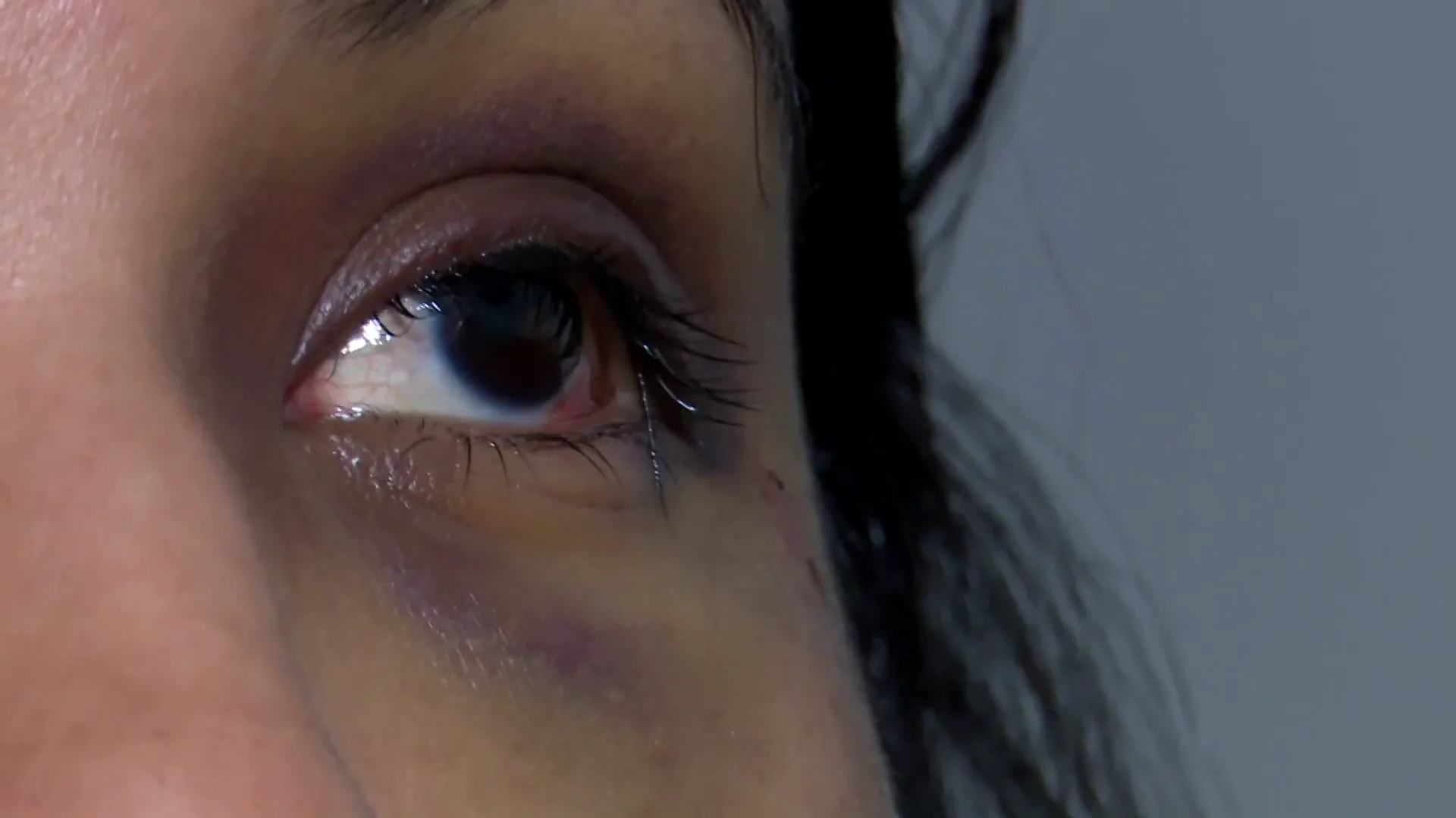 La mujer v&iacute;ctima de una agresi&oacute;n con taladro
