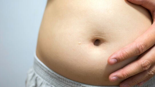 Hinchaz&oacute;n abdominal