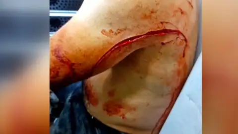 Agresión a un padre porque sus hijos molestaban con la pelota Agresión a un padre porque sus hijos molestaban con la pelota