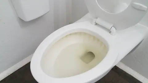 Inodoro con cal Inodoro con cal