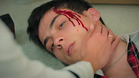 Sarp sufre una grave caída en el almacén… ¡Y culpa a Ömer de haberlo empujado! Sarp sufre una grave caída en el almacén… ¡Y culpa a Ömer de haberlo empujado!