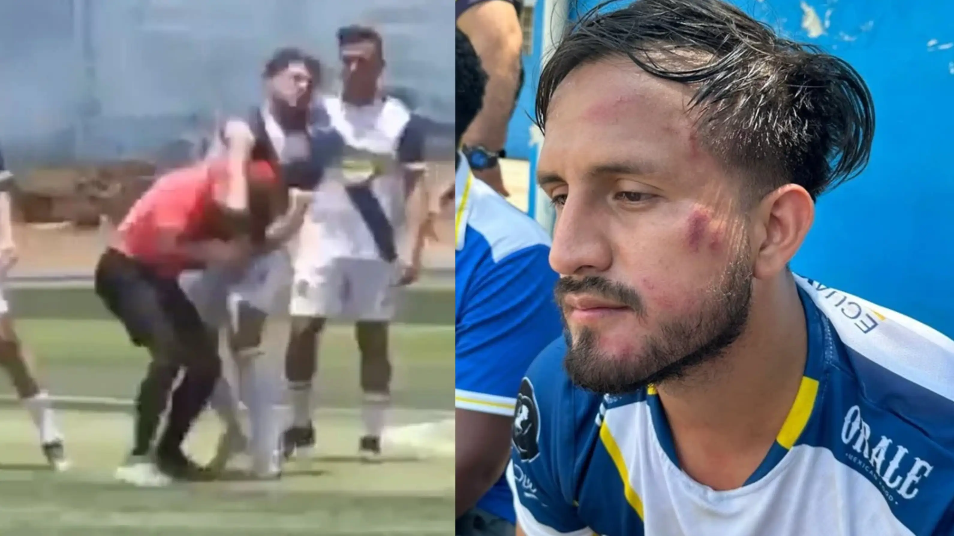 Un árbitro y un futbolista se lían a puñetazos Un árbitro y un futbolista se lían a puñetazos