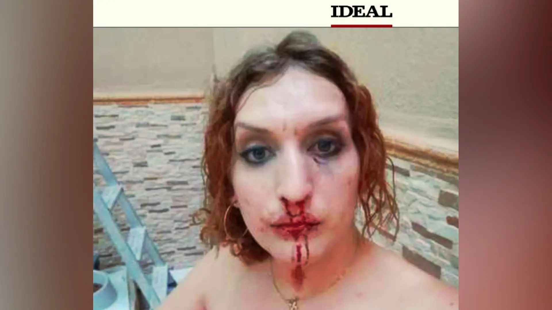 Investigan la presunta agresi&oacute;n a una mujer transexual