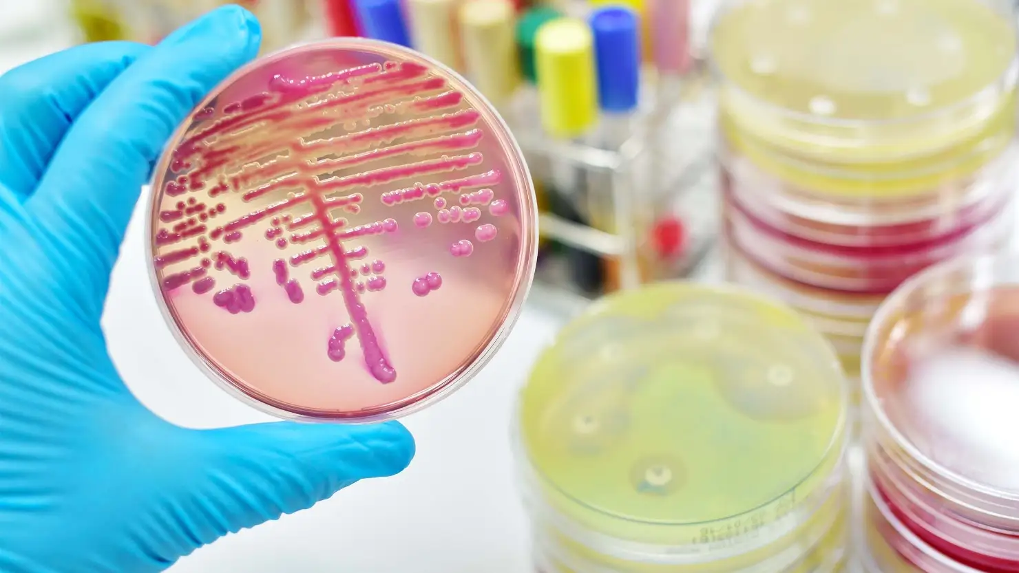 Porbióticos Un estudio aborda la funcion de las bacterias intestinales para desarrollar nuevos probioticos