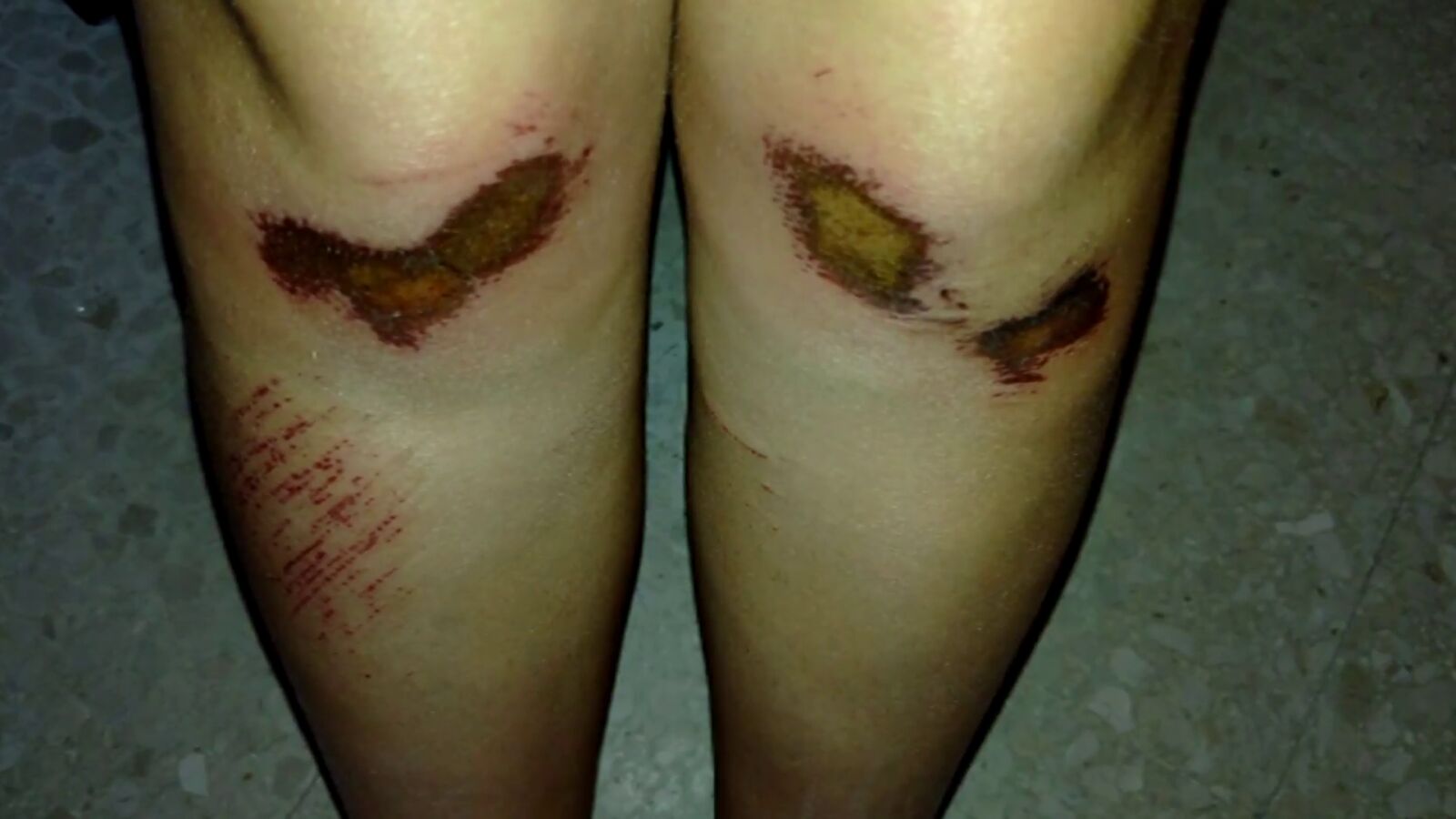 Brutal agresión de una pandilla de niñas a otra en Sevilla para robarle