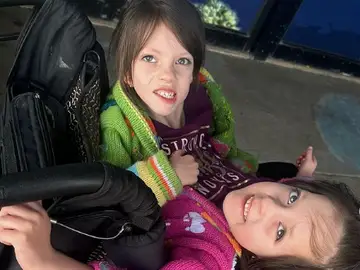 Las hermanas siamesas Las hermanas siamesas