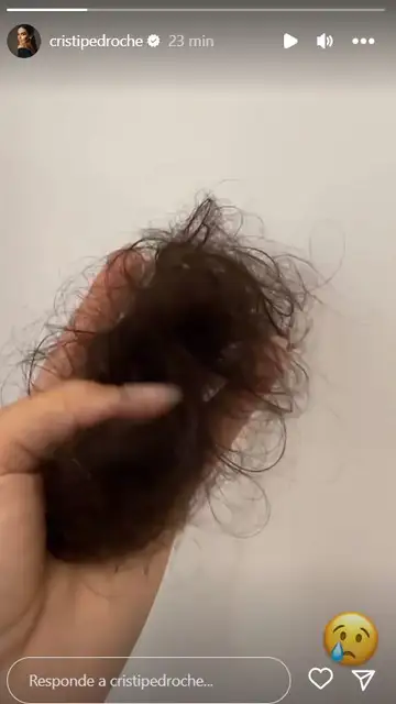 Caída de pelo de Cristina Pedroche Caída de pelo de Cristina Pedroche