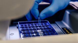 Una muestra de laboratorio