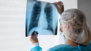 Médico revisando radiografía Médico revisando radiografía